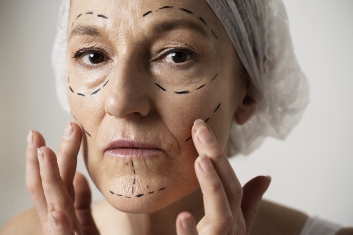 Rajeunissement du visage après 50 ans : les chirurgies à Bordeaux